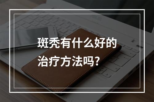 斑秃有什么好的治疗方法吗?