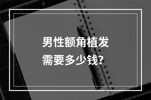 男性额角植发需要多少钱？