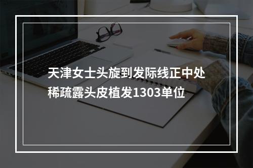 天津女士头旋到发际线正中处稀疏露头皮植发1303单位