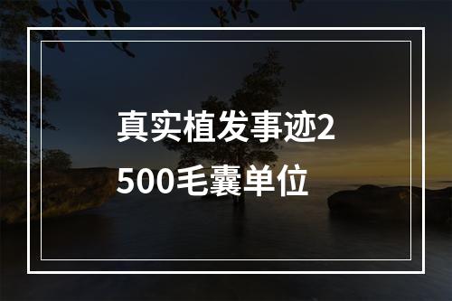 真实植发事迹2500毛囊单位