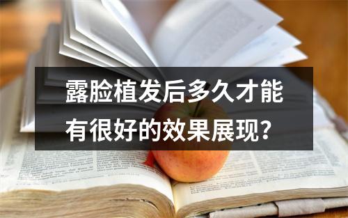 露脸植发后多久才能有很好的效果展现？