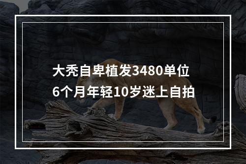 大秃自卑植发3480单位6个月年轻10岁迷上自拍