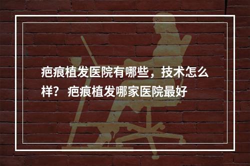 疤痕植发医院有哪些，技术怎么样？ 疤痕植发哪家医院最好