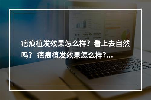 疤痕植发效果怎么样？看上去自然吗？ 疤痕植发效果怎么样?看上去自然吗