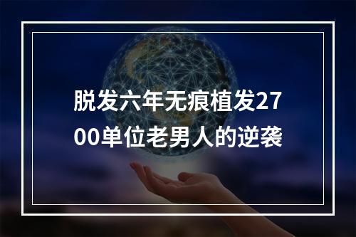 脱发六年无痕植发2700单位老男人的逆袭