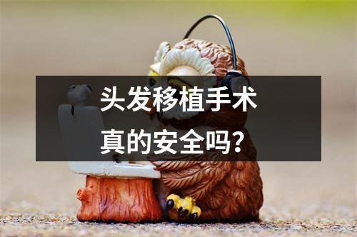 头发移植手术真的安全吗？