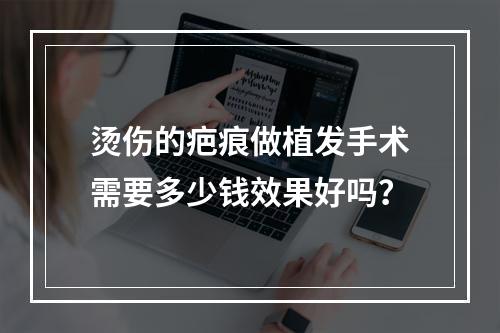 烫伤的疤痕做植发手术需要多少钱效果好吗？