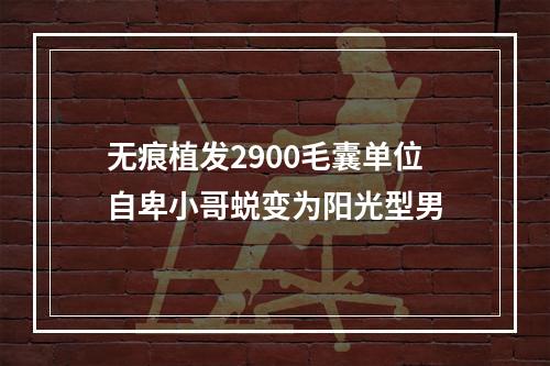 无痕植发2900毛囊单位自卑小哥蜕变为阳光型男