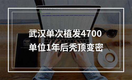 武汉单次植发4700单位1年后秃顶变密