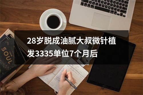 28岁脱成油腻大叔微针植发3335单位7个月后