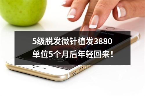 5级脱发微针植发3880单位5个月后年轻回来！