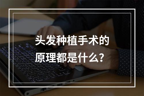 头发种植手术的原理都是什么？