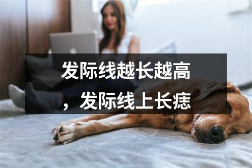 发际线越长越高，发际线上长痣