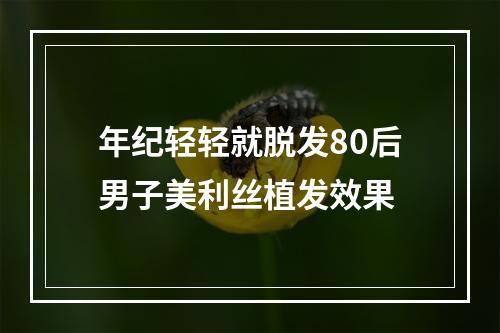 年纪轻轻就脱发80后男子美利丝植发效果