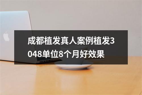 成都植发真人案例植发3048单位8个月好效果