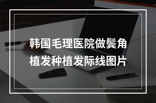 韩国毛理医院做鬓角植发种植发际线图片