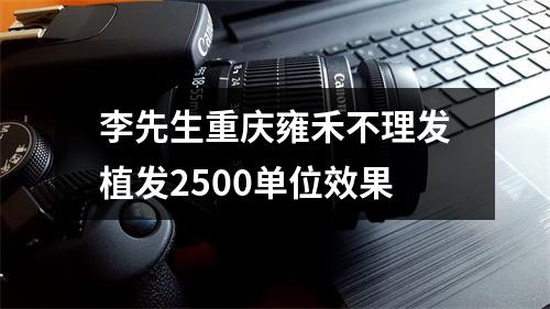 李先生重庆雍禾不理发植发2500单位效果