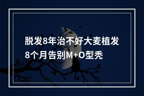 脱发8年治不好大麦植发8个月告别M+O型秃