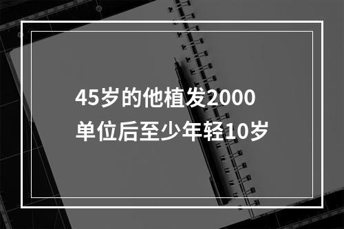 45岁的他植发2000单位后至少年轻10岁