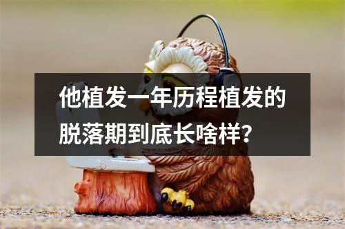 他植发一年历程植发的脱落期到底长啥样？