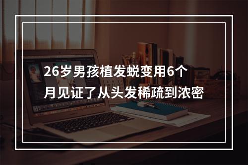 26岁男孩植发蜕变用6个月见证了从头发稀疏到浓密