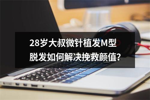 28岁大叔微针植发M型脱发如何解决挽救颜值？