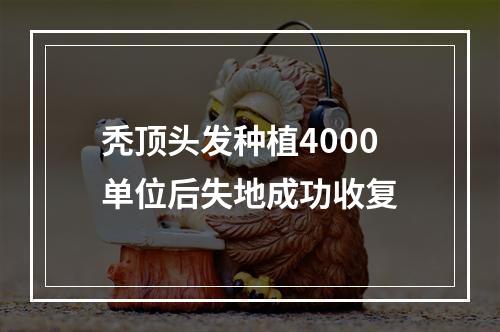 秃顶头发种植4000单位后失地成功收复