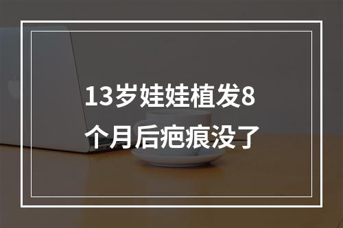 13岁娃娃植发8个月后疤痕没了