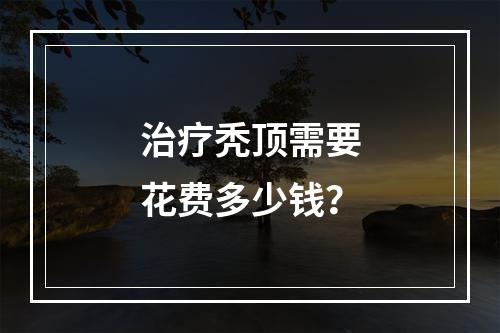 治疗秃顶需要花费多少钱？