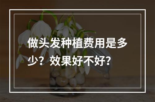 做头发种植费用是多少？效果好不好？