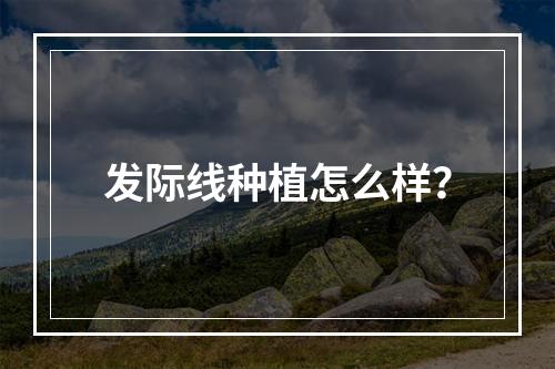 发际线种植怎么样？