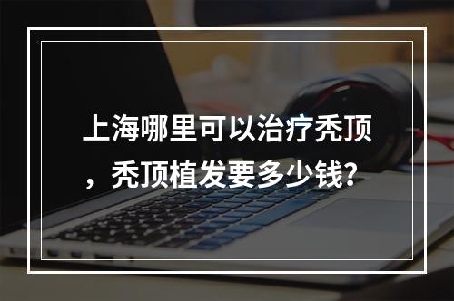 上海哪里可以治疗秃顶，秃顶植发要多少钱？