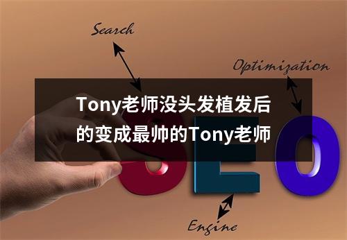 Tony老师没头发植发后的变成最帅的Tony老师