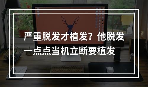 严重脱发才植发？他脱发一点点当机立断要植发