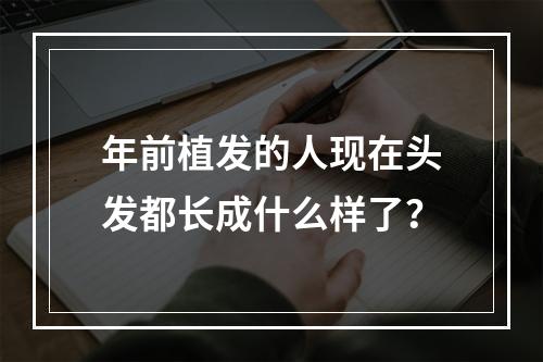 年前植发的人现在头发都长成什么样了？