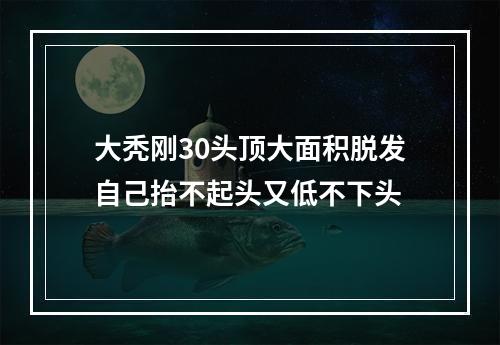 大秃刚30头顶大面积脱发自己抬不起头又低不下头