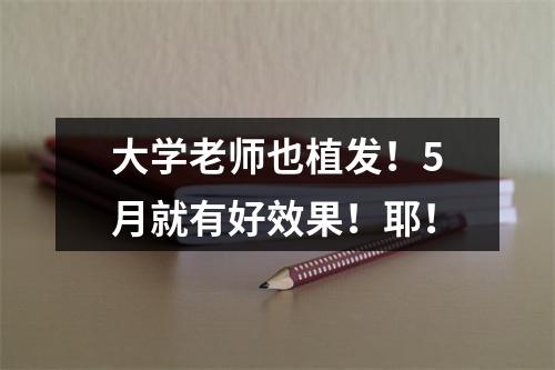 大学老师也植发！5月就有好效果！耶！