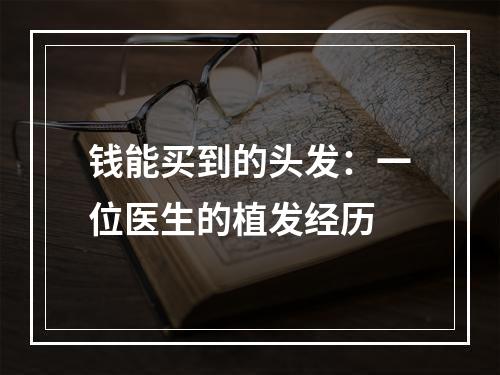 钱能买到的头发：一位医生的植发经历