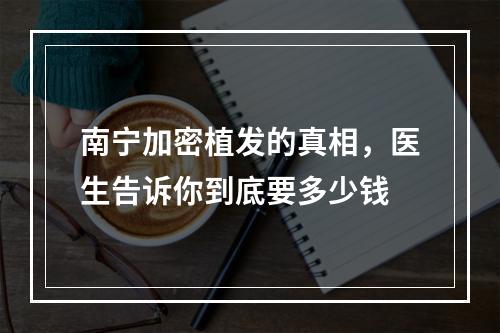 南宁加密植发的真相，医生告诉你到底要多少钱