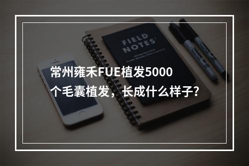 常州雍禾FUE植发5000个毛囊植发，长成什么样子？