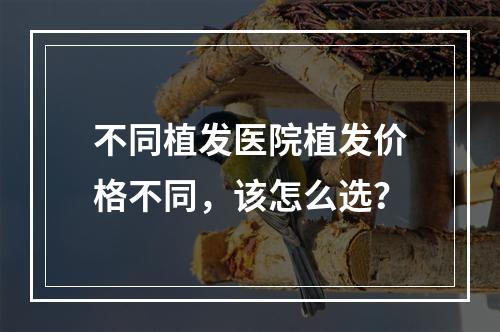 不同植发医院植发价格不同，该怎么选？