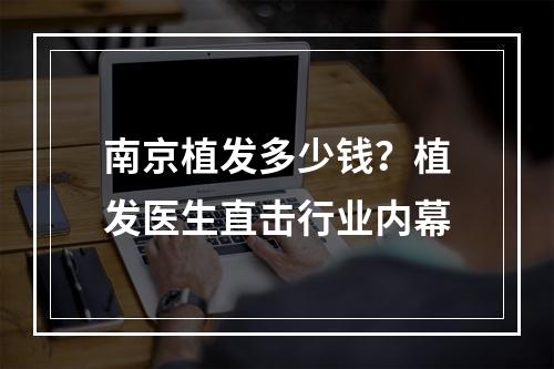 南京植发多少钱？植发医生直击行业内幕