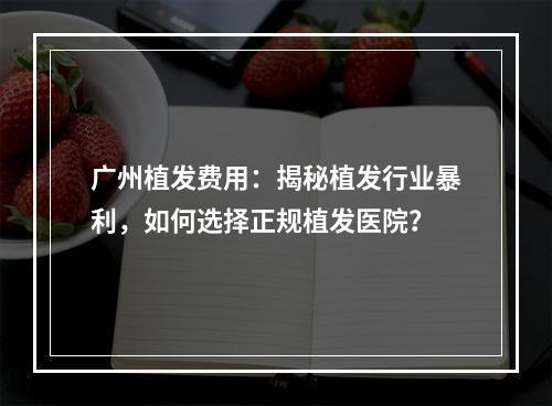 广州植发费用：揭秘植发行业暴利，如何选择正规植发医院？