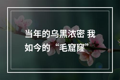 当年的乌黑浓密 我如今的“毛窟窿”