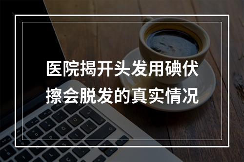 医院揭开头发用碘伏擦会脱发的真实情况