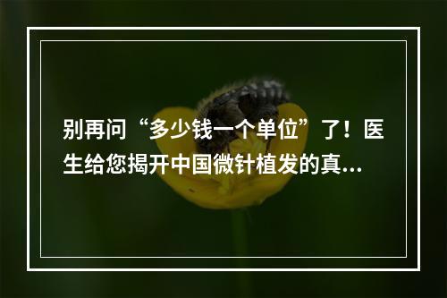 别再问“多少钱一个单位”了！医生给您揭开中国微针植发的真相！