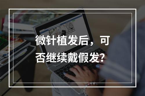 微针植发后，可否继续戴假发？