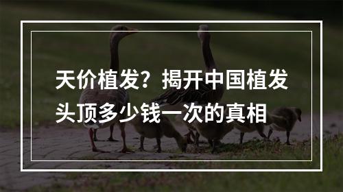 天价植发？揭开中国植发头顶多少钱一次的真相