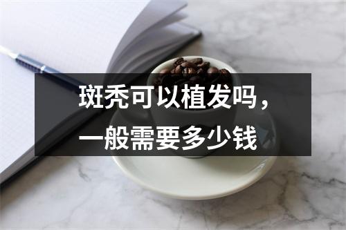 斑秃可以植发吗，一般需要多少钱