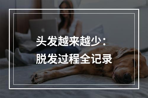 头发越来越少：脱发过程全记录